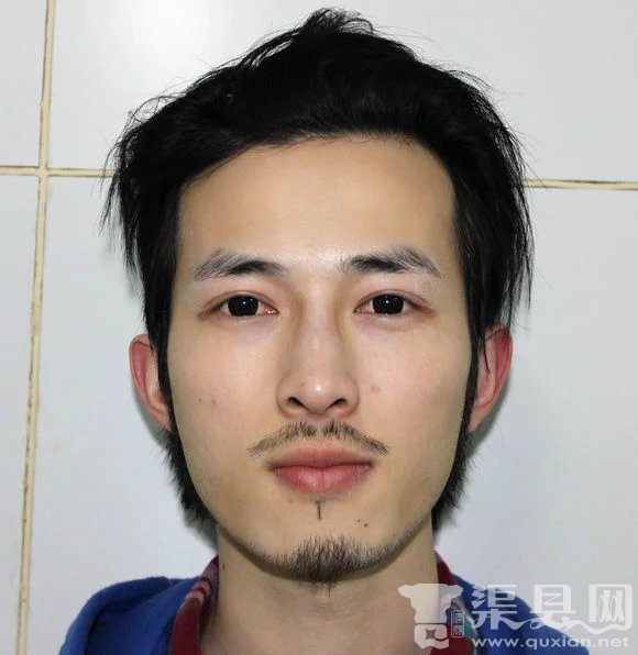 有渠县的，在重庆做过双眼皮的吗？求介绍。就这样的