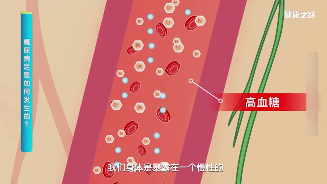 双脚出现这5个变化，一定要留意！
