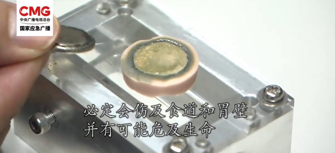 一幼儿食道被腐蚀！家里这种“小圆片”千万要收好