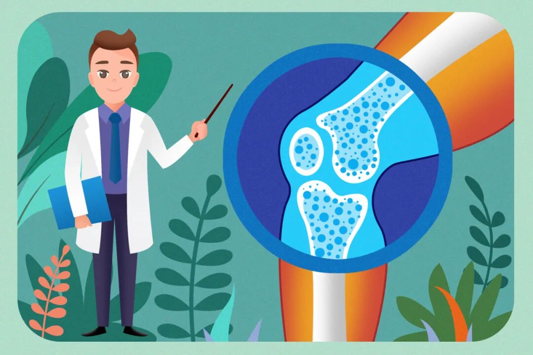 骨密度检查，两类人群可以不做 | 健康体检