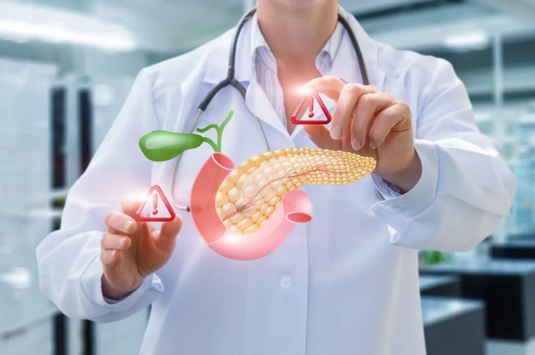 饭后出现 4 种症状，警惕胰腺癌！尤其是这类人