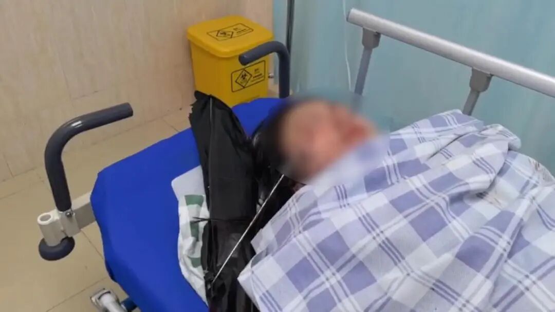 可能刺入手、眼、脸！电动自行车上这个危险装置，不要装！
